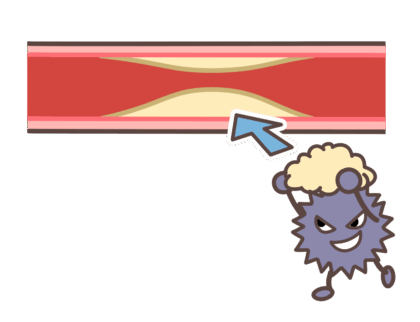 悪玉コレステロール