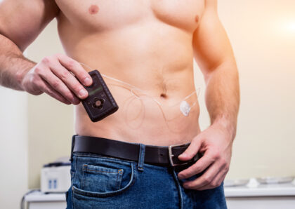 インスリンポンプ